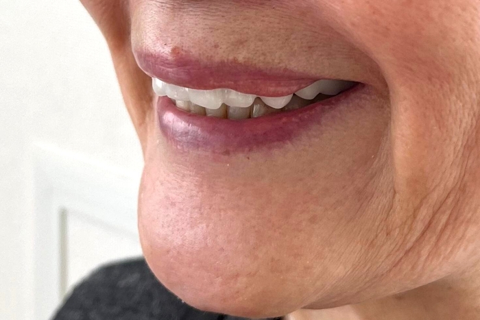 白一色の装着時