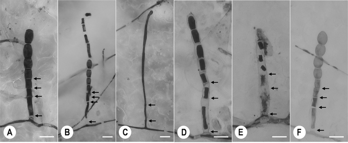 図1　農薬を処理されたメロンうどんこ病菌の単一菌叢内で観察された、正常（A）および異常な（B～F）分生子柄の形態。農薬処理後3日目に生体染色し、光学顕微鏡で観察した。
