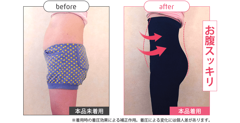 ストレグ横腹Before/After