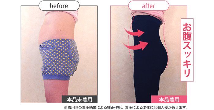 ストレグ横腹Before/After