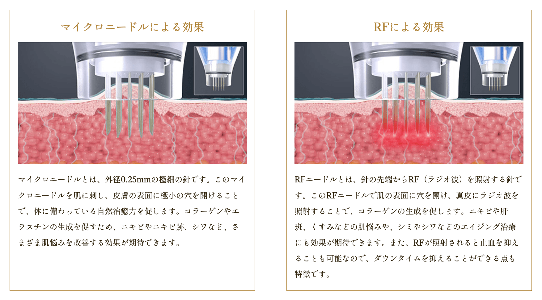ポテンツァの特徴