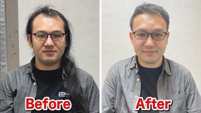 M字薄毛をカットで改善(1)