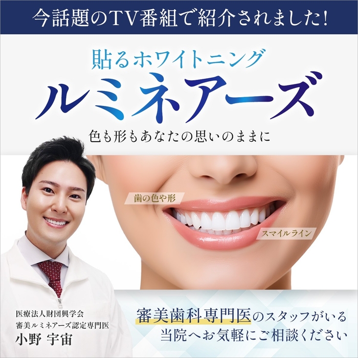 ルミネーズ（貼るホワイトニング）