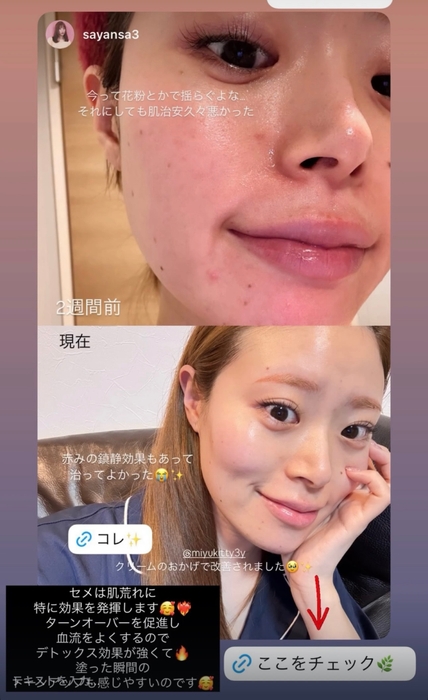 インフルエンサー使用画像