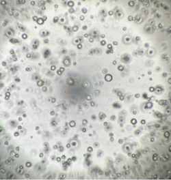 ヒト膵がん患者由来オルガノイドの増殖試験(8日後) b) 既存ポリスチレン製プレート/地方独立行政法人大阪府立病院機構大阪国際がんセンター 平塚 徹 チームリーダー ご提供