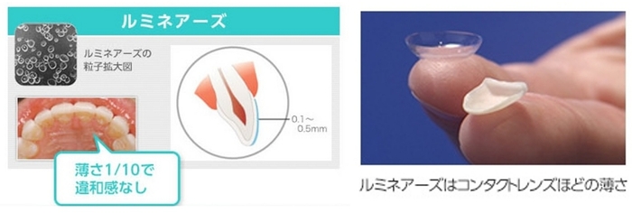 貼るホワイトニングの「ルミネアーズ」