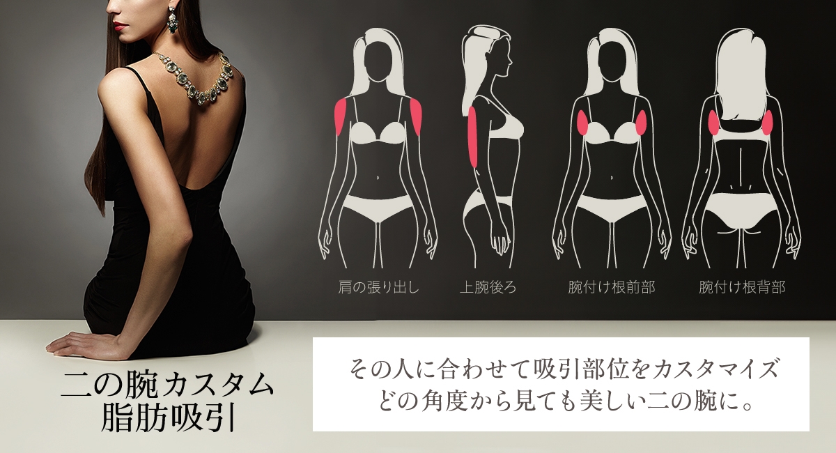 ベイザー脂肪吸引20,000症例突破記念・二の腕カスタム脂肪吸引キャンペーンを実施中