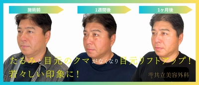 元東京ヤクルトスワローズ監督・真中満氏が共立美容外科で実感！ 自然なクマ取りで若々しい印象へ