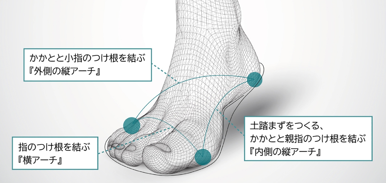 アーチサポート