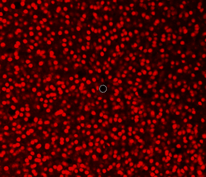 図：直径5 µmマイクロニードル電極周辺の神経細胞（ニューロン）の観察