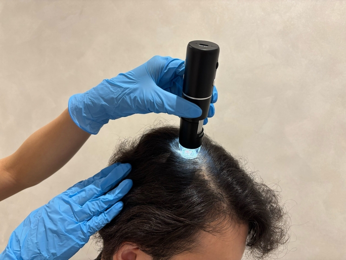 施術イメージ(2)