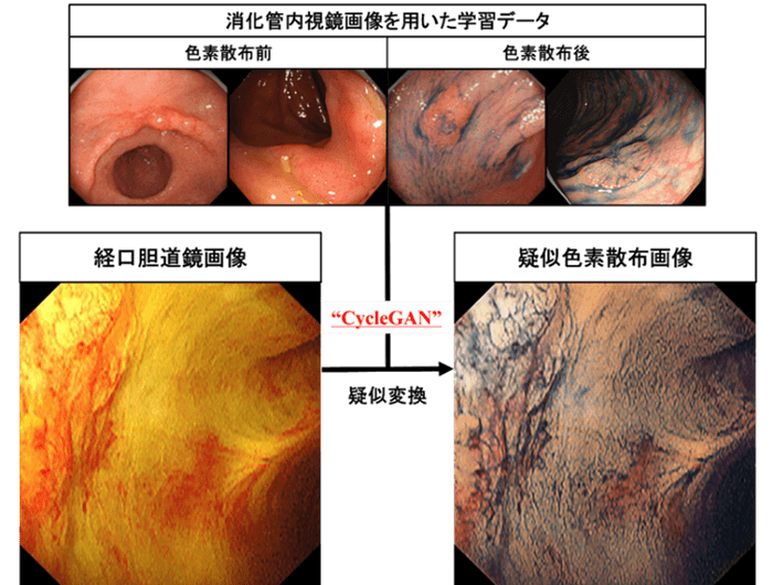 図1:白色光画像(左)から疑似色素散布画像(右)へのAIによる変換技術