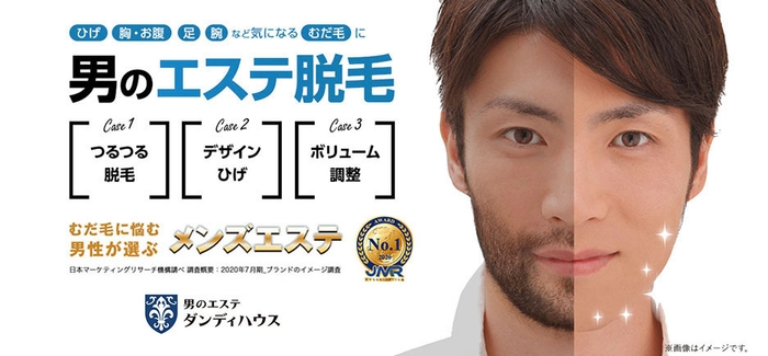 ダンディハウス 男のエステ脱毛