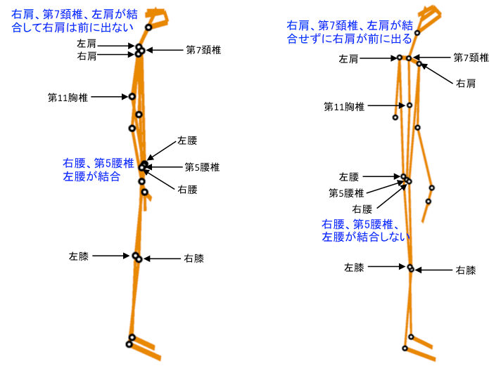 図1(Ⅰ型タイプの『Csc』画像           図2(Ⅱ型タイプの『Csc』画像)