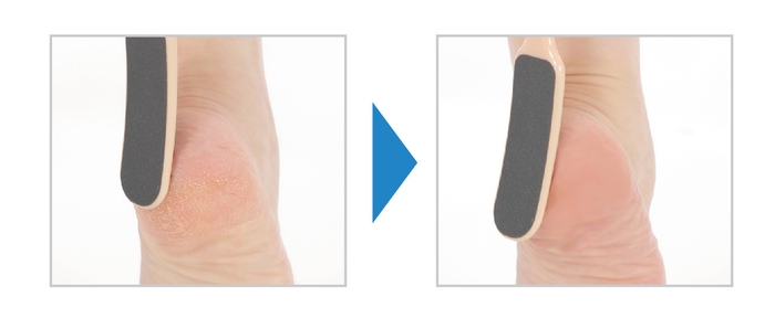 ツルもちカカトに!