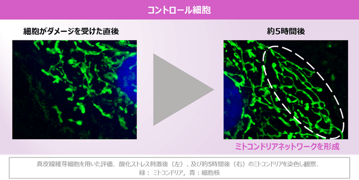 図2 コントロール細胞でのミトコンドリアネットワーク形成