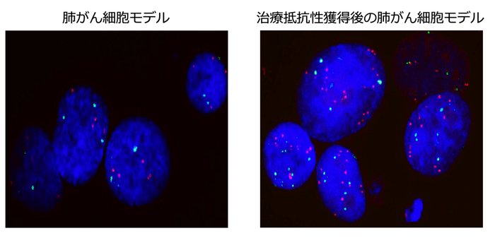 KRAS阻害薬抵抗性獲得前後におけるMET遺伝子のFISH画像の比較