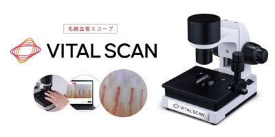 血行に着目した健康意識向上の取り組み　 毛細血管スコープ「VITAL SCAN(バイタルスキャン)」販売開始