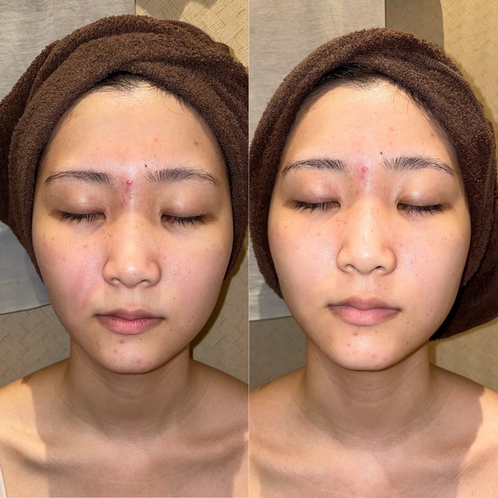 使用感、ビフォーアフター