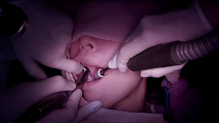 わずか0.4mm 歯の形を変えるだけで滑舌が良くなる!!