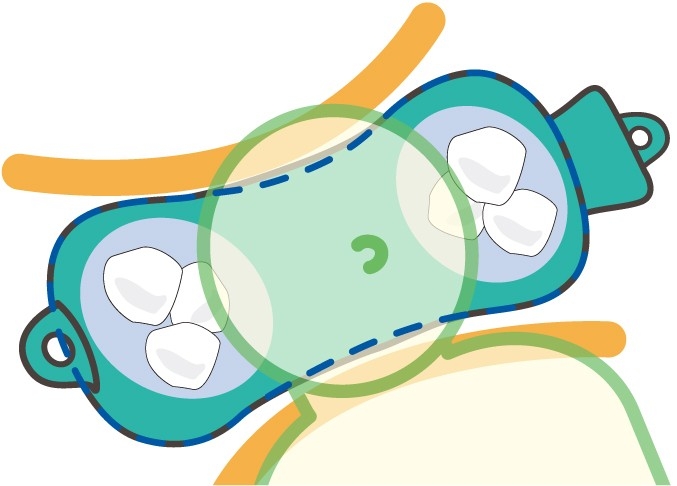 頭の位置が安定するボーン型