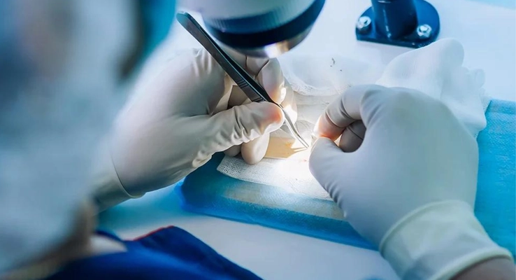 日本人にトルコ植毛を紹介する植毛エージェント「飛んで植毛」 日本円の定額制期間限定キャンペーン開始　 ～業界屈指の技術とフルサポート付き植毛ツアー～