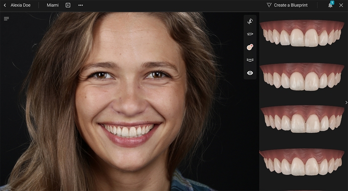 スマイルデザイン