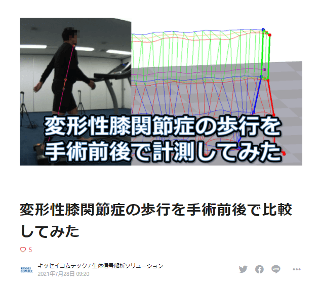 ◇ブログの記事例:「変形性膝関節症の歩行を手術前後で計測してみた」