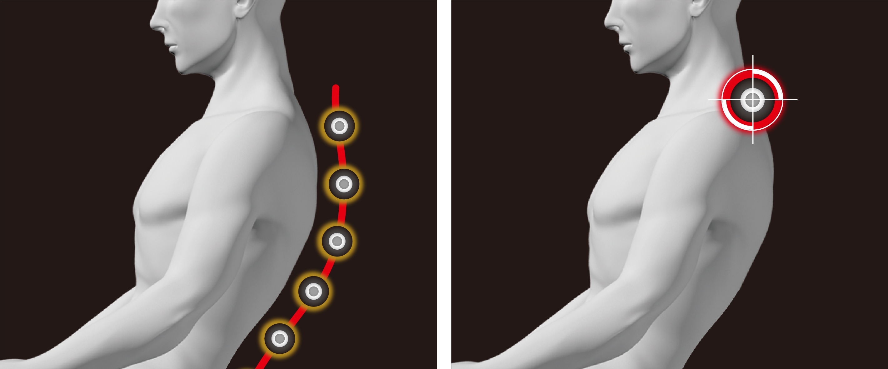 ダブルセンシング