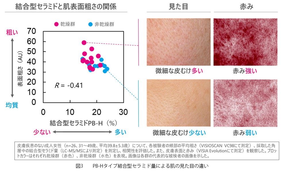 図3  PB-Hタイプ結合型セラミド量による肌の見た目の違い