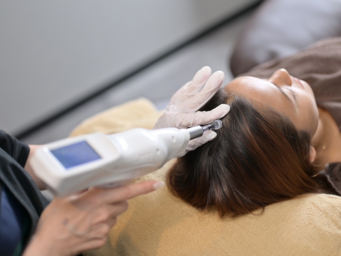 美髪(AGA)ケアコース 施術イメージ