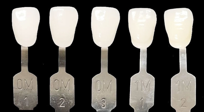 ハリウッドスマイルの白さ「ルミネアーズ」