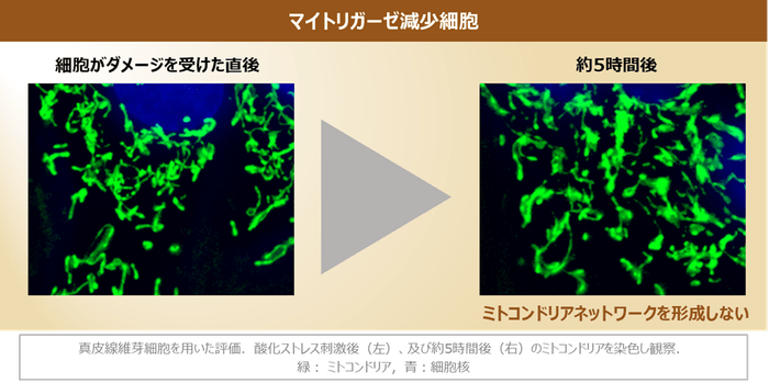 図3 マイトリガーゼの減少によるミトコンドリアネットワーク形成の阻害