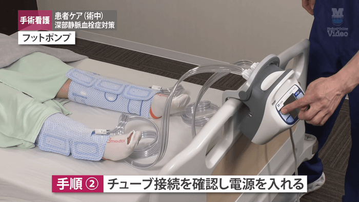 深部静脈血栓症対策