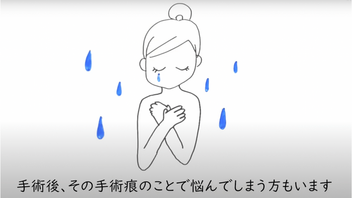 手術痕で悩む人も