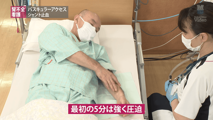 バスキュラーアクセス シャント止血