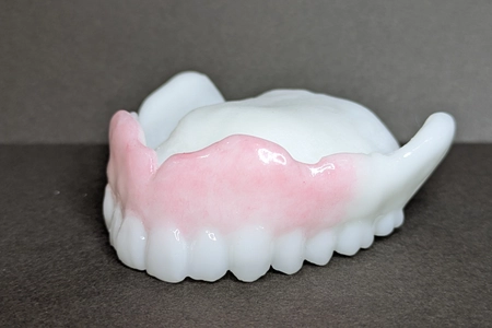 死亡率を下げる夜専用「おやすみ入れ歯」　 日本初の入れ歯型マウスピースが、提供開始3年で製作数160個超え