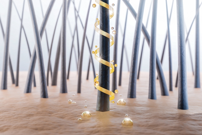 ロックイン処方