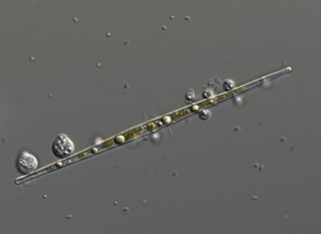 図1.植物プランクトンのイタケイソウの仲間(Ulnaria sp.)に寄生したツボカビ(Rhizophydiales sp.)が成熟し、胞子嚢(のう)になったところ