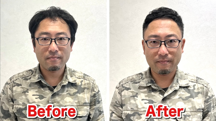 M字薄毛をカットで改善(3)