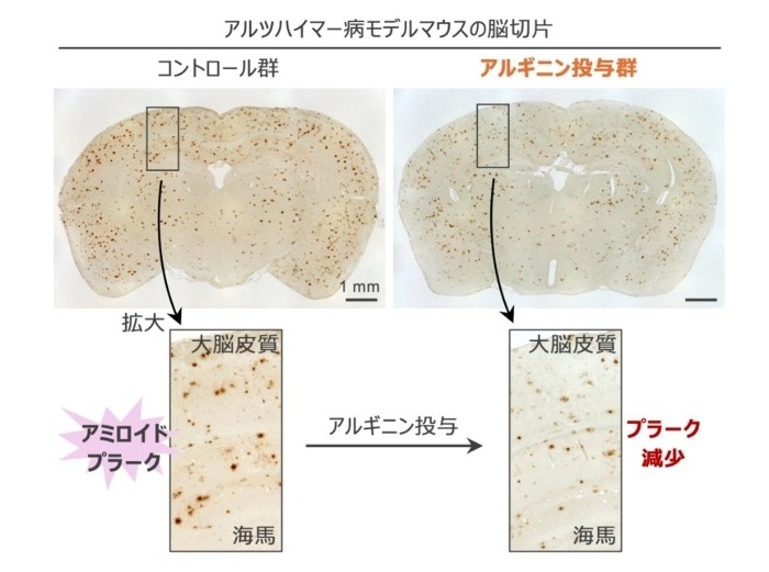 図2　アルツハイマー病モデルマウスの脳切片画像、茶色の斑点がアミロイドβの蓄積を表す。 （左）コントロール群、（右）アルギニン投与群