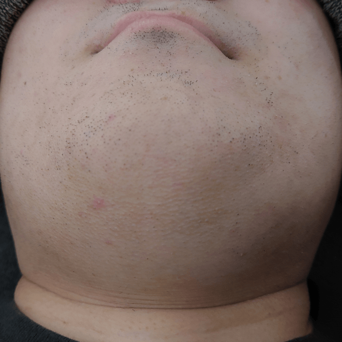 6回目の写真