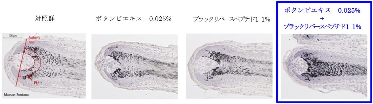 Auber's line:毛球部の最も太い部分を横断する線  PU:メラニン量測定エリア