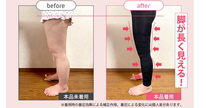 ストレグ脚のBefore/After