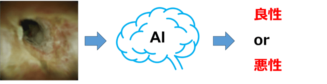 図2:AIによる胆道鏡画像の良悪性診断支援のイメージ