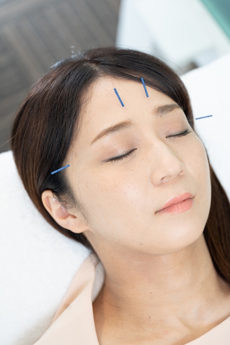 はりをした写真