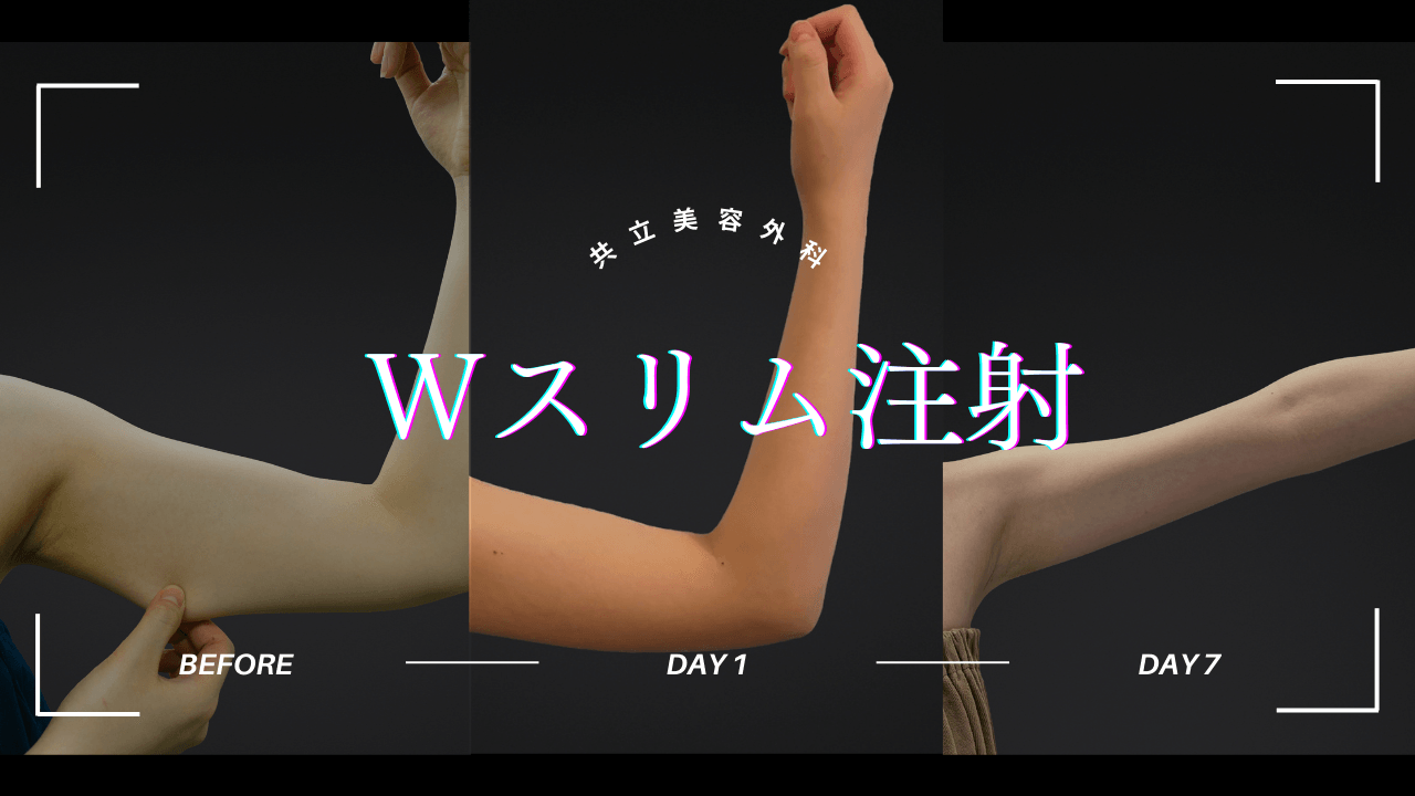 Wスリム注射症例写真