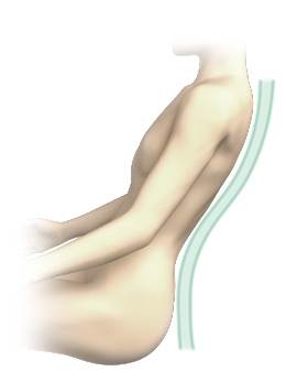 S字フィットフレーム