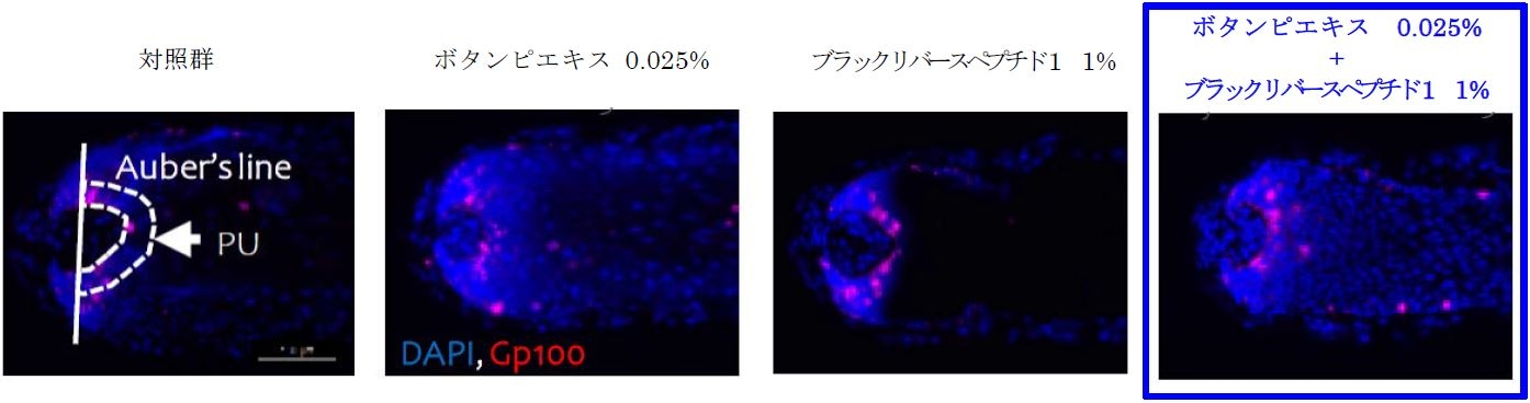 Auber's line:毛球部の最も太い部分を横断する線   PU:Gp100量測定エリア  *赤く染色されている部分がGp100