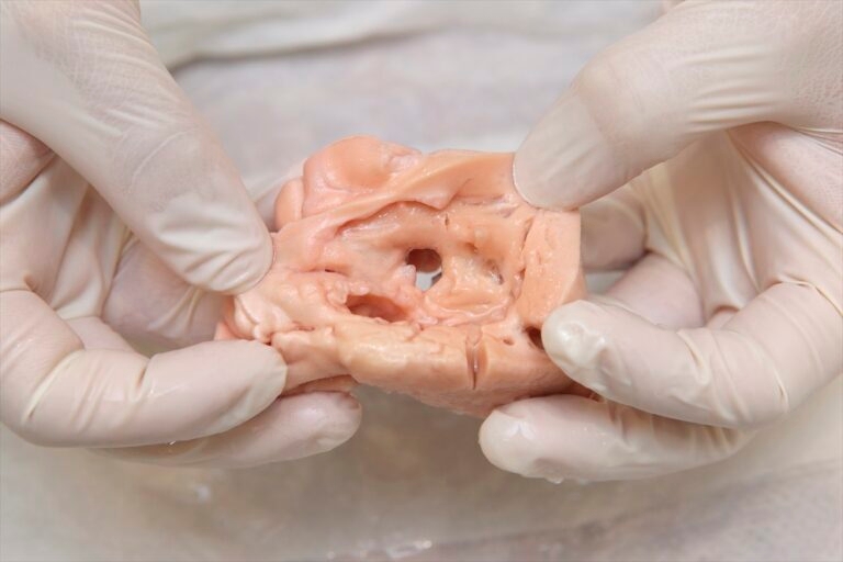 術前シミュレーター